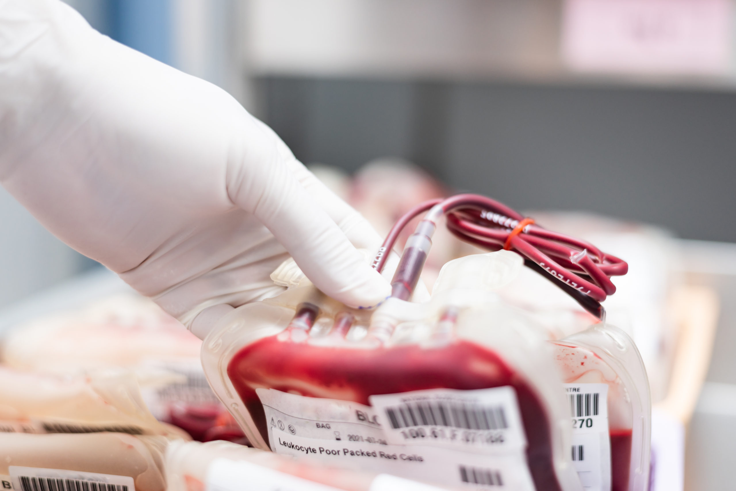 [:de]Blutbesstrahlung vor einer Transfusion verhindert TA-GvHD[:en]Blood irradiation prior to transfusion prevents TA-GvHD[:]